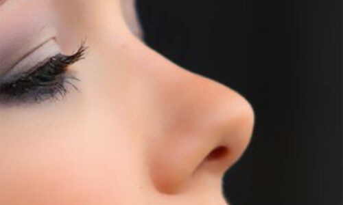 Rhinoplastie Lyon : Devenir plus belle grâce à la rhinoplastie