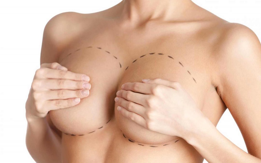 Améliorer la forme de vos seins grâce à une augmentation mammaire